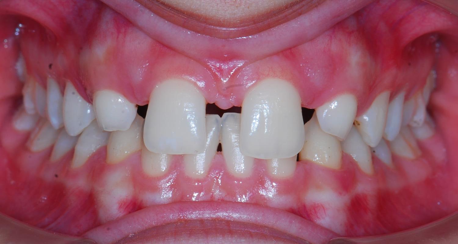 ESTETİK RESTORATİF DİŞ HEKİMLİĞİ